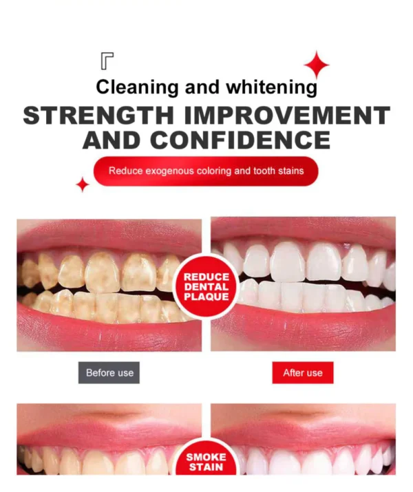 Yayashi SP4 Oral Care Probiotic Whitening Toothpaste 120g - Image 13