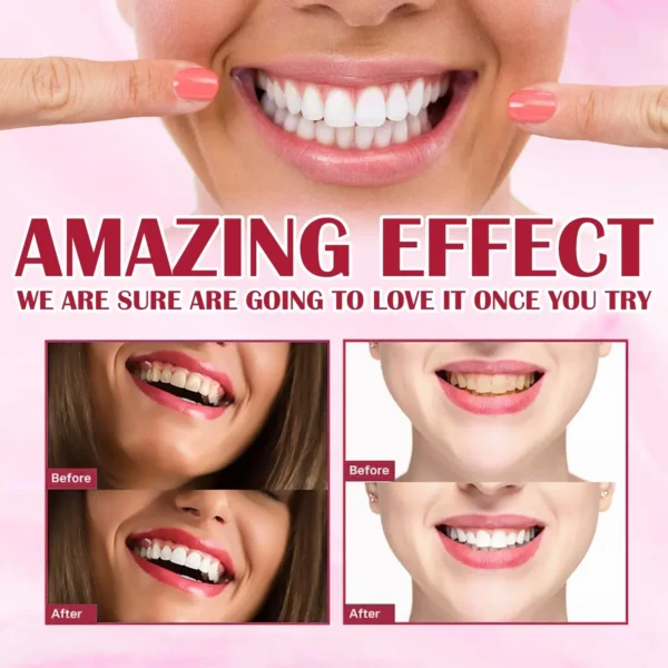 Yayashi SP4 Oral Care Probiotic Whitening Toothpaste 120g - Image 4