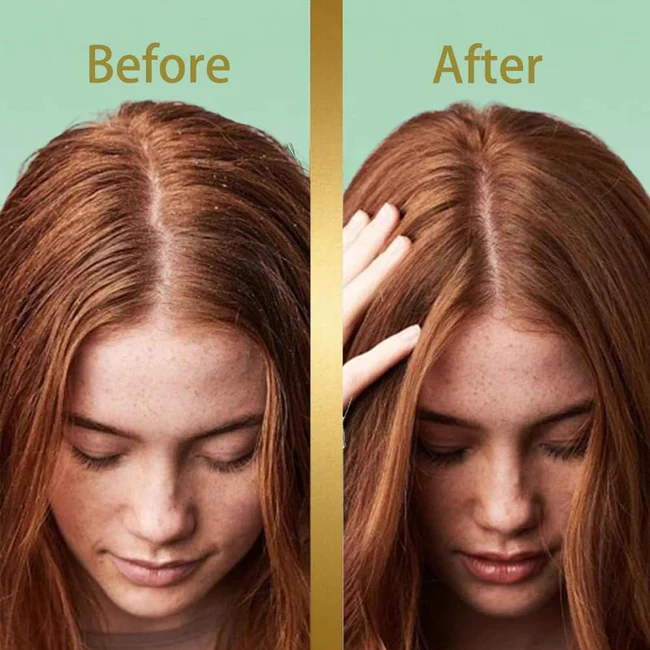 HerbaGlow Solid Shampoo Bar | Natural Hair Growth Shampoo Bar - Image 5