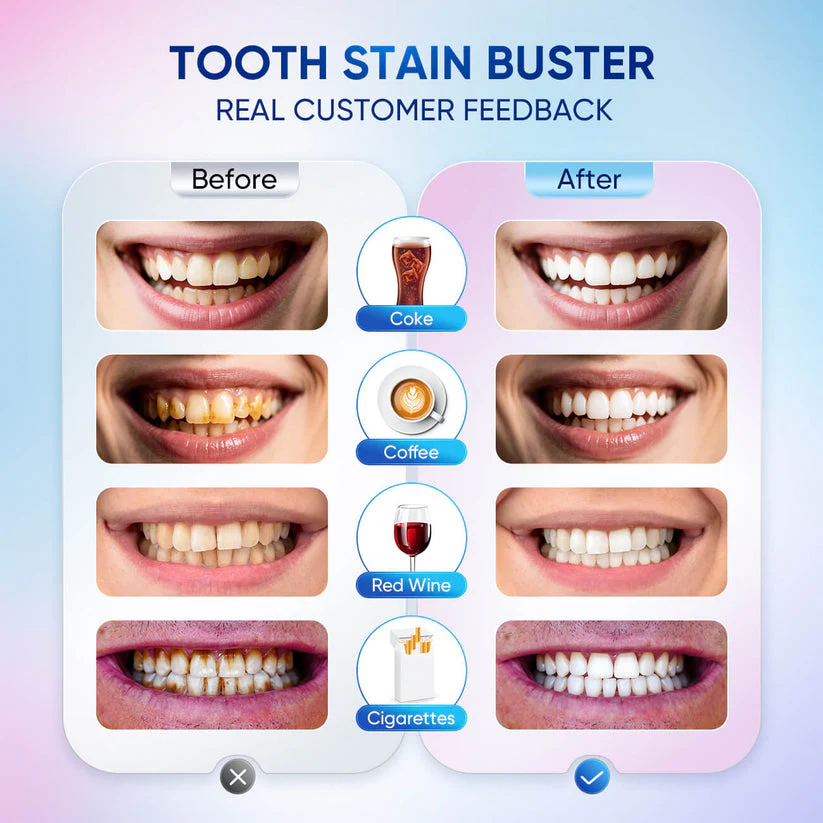 Niacinamide Whitening Toothpaste - For Healthier, Whiter Teeth! - Image 4