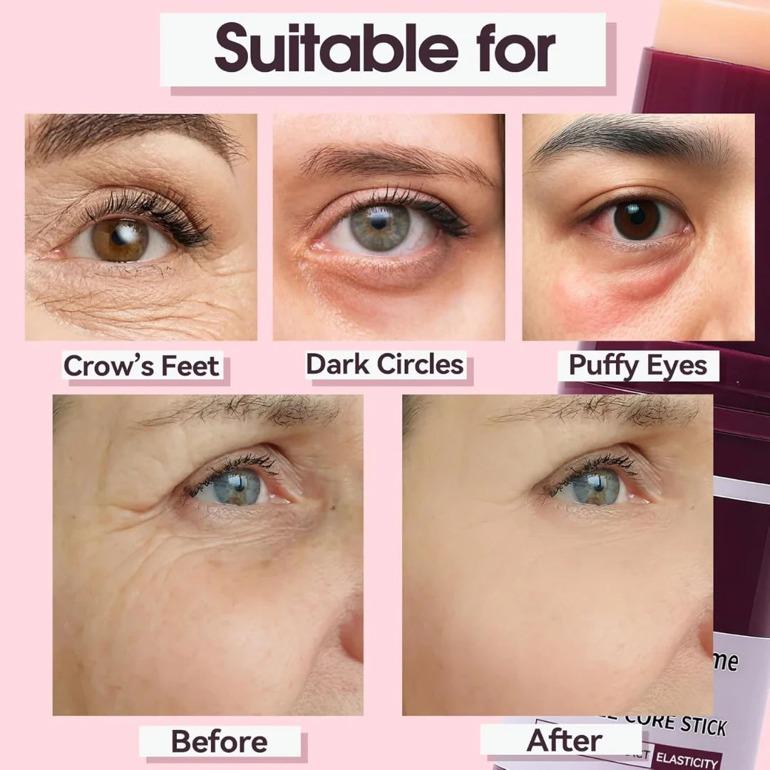 Calcium & Collagen Balm Stick | Remove Wrinkles, Smile Lines & Gives Hydration & Glow - Image 8