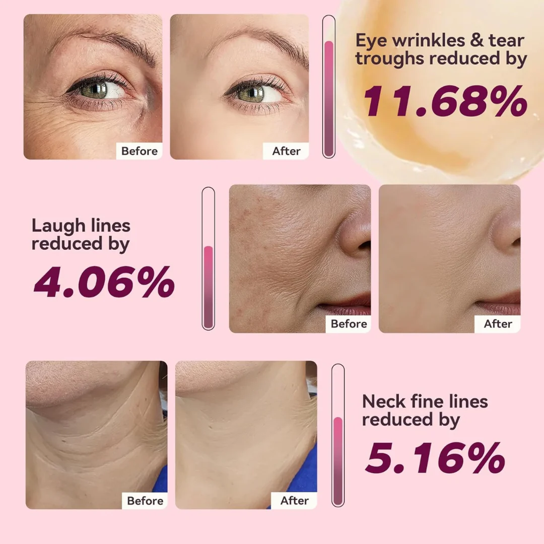 Calcium & Collagen Balm Stick | Remove Wrinkles, Smile Lines & Gives Hydration & Glow - Image 4