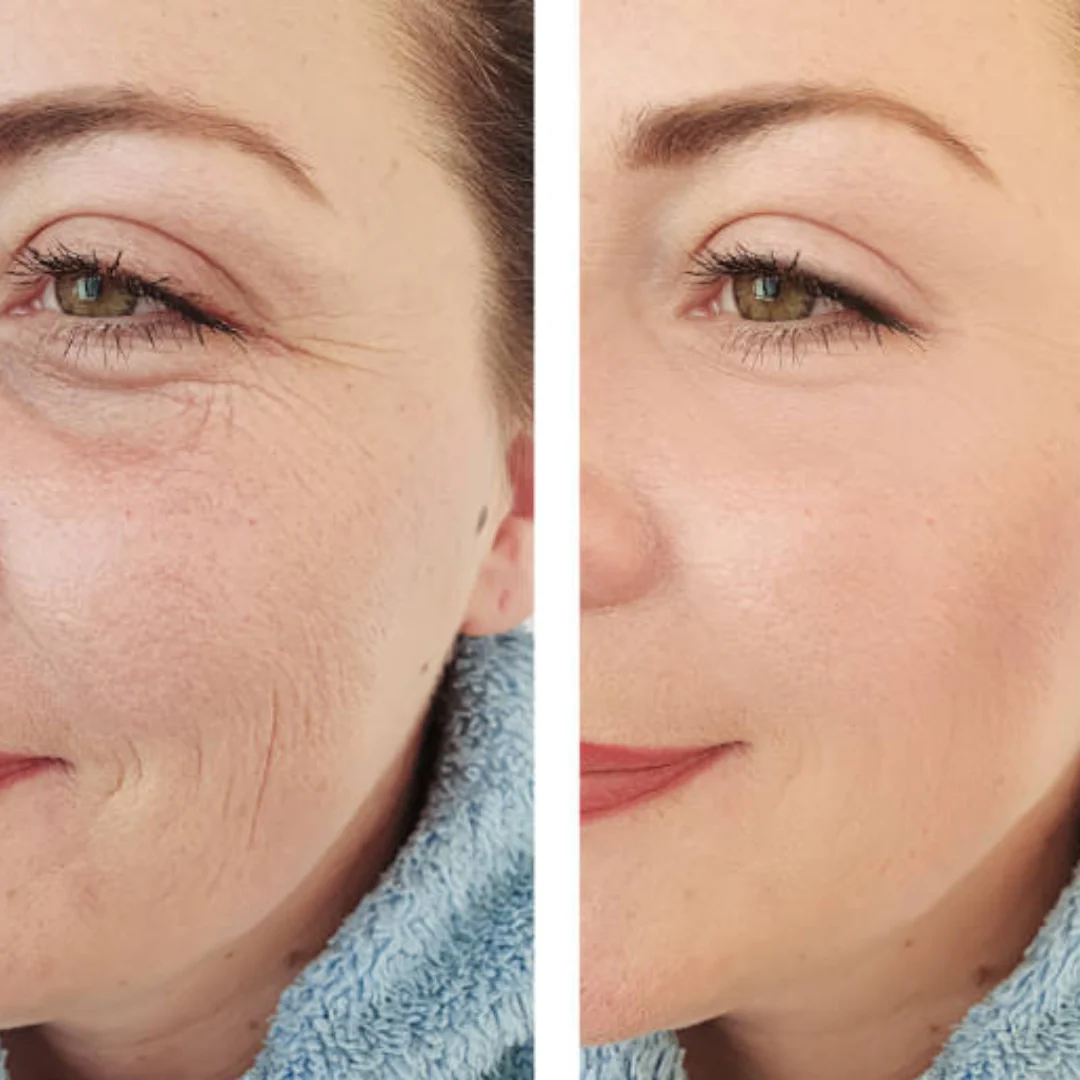 Calcium & Collagen Balm Stick | Remove Wrinkles, Smile Lines & Gives Hydration & Glow - Image 2