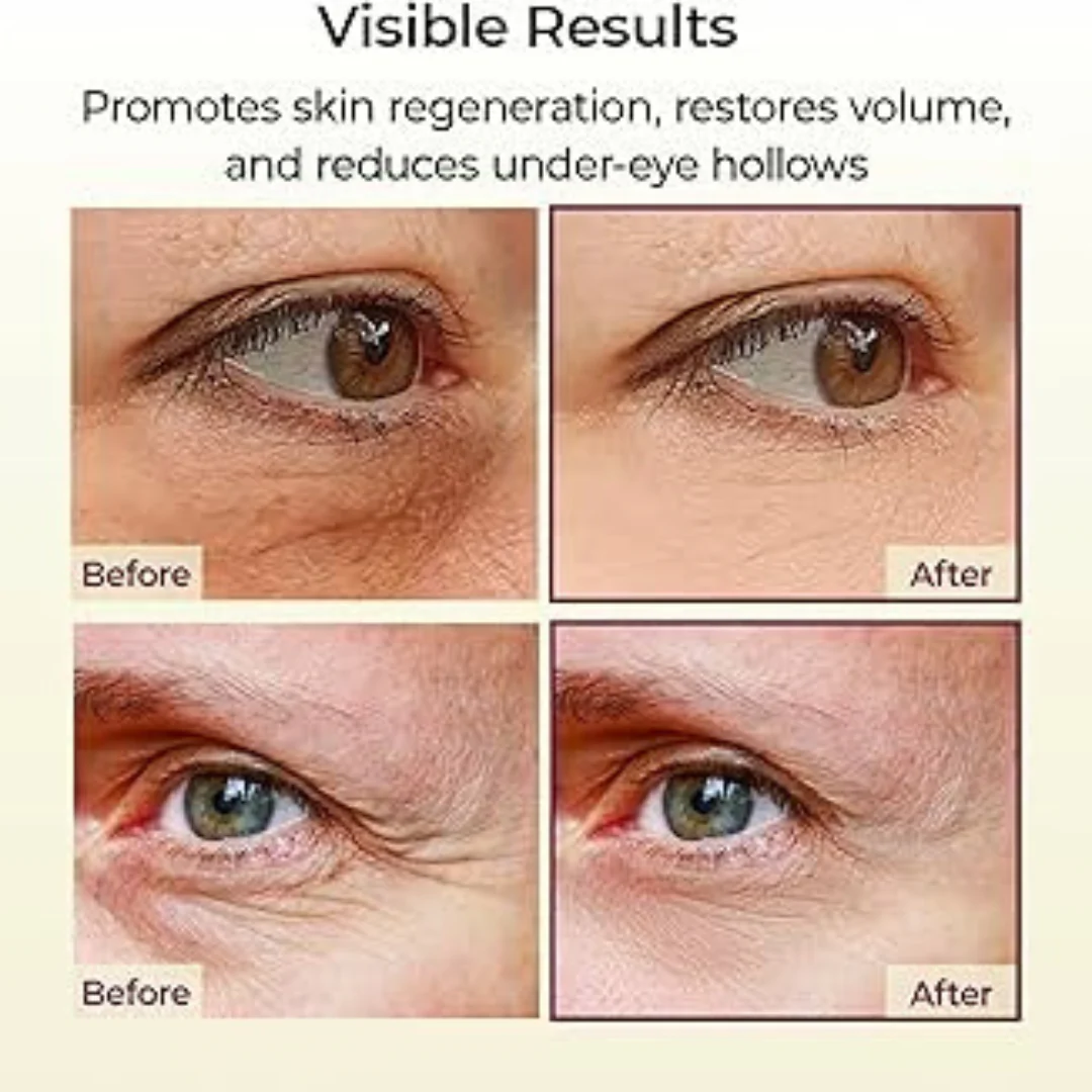 Calcium & Collagen Balm Stick | Remove Wrinkles, Smile Lines & Gives Hydration & Glow - Image 12