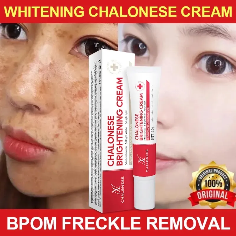 CHALONESE Brightening Cream Serum – 20g - Image 2