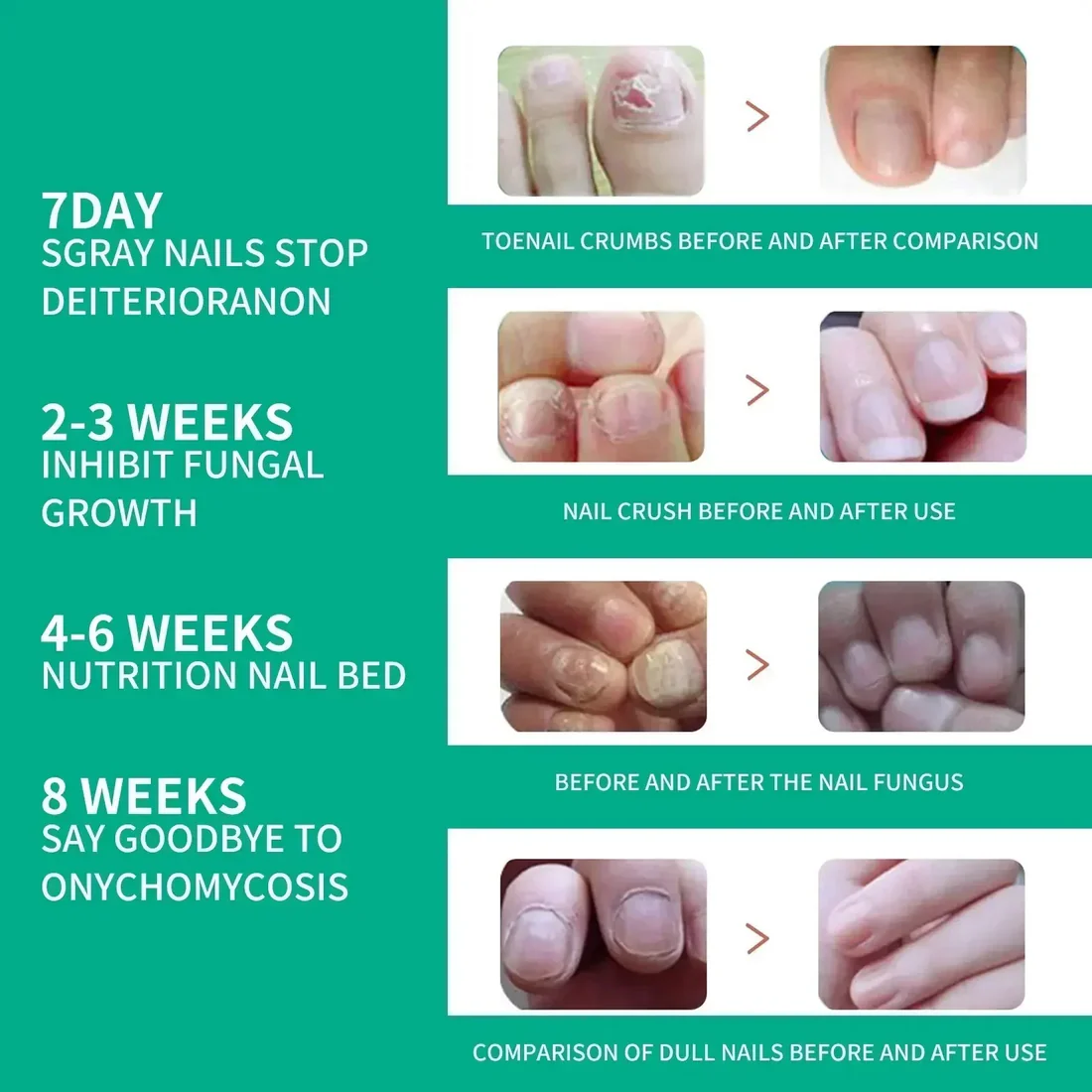 Nexusdrop Nail Fungus Solution - Image 2