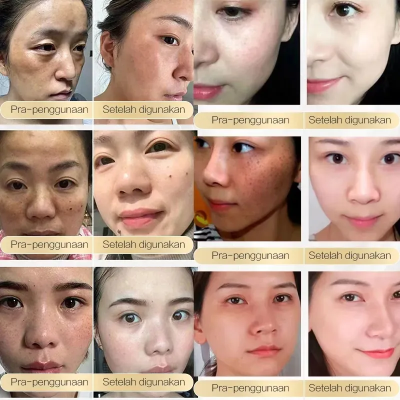 CHALONESE Brightening Cream Serum – 20g - Image 4