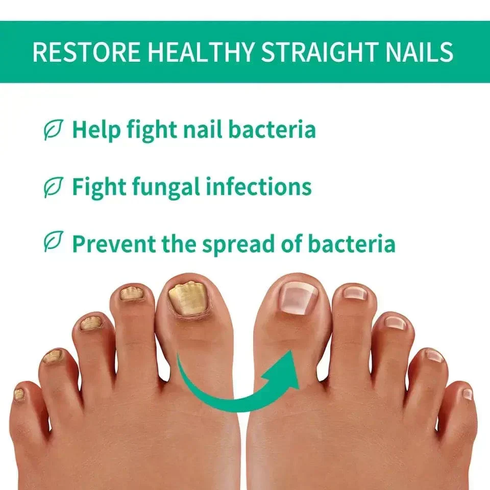 Nexusdrop Nail Fungus Solution - Image 7