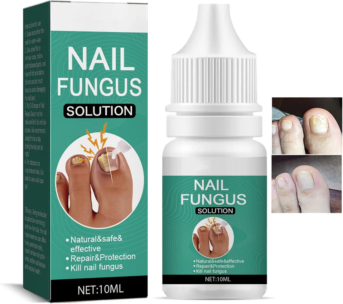 Nexusdrop Nail Fungus Solution - Image 5