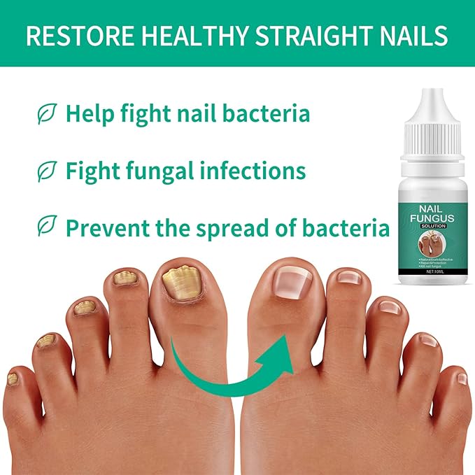 Nexusdrop Nail Fungus Solution - Image 4