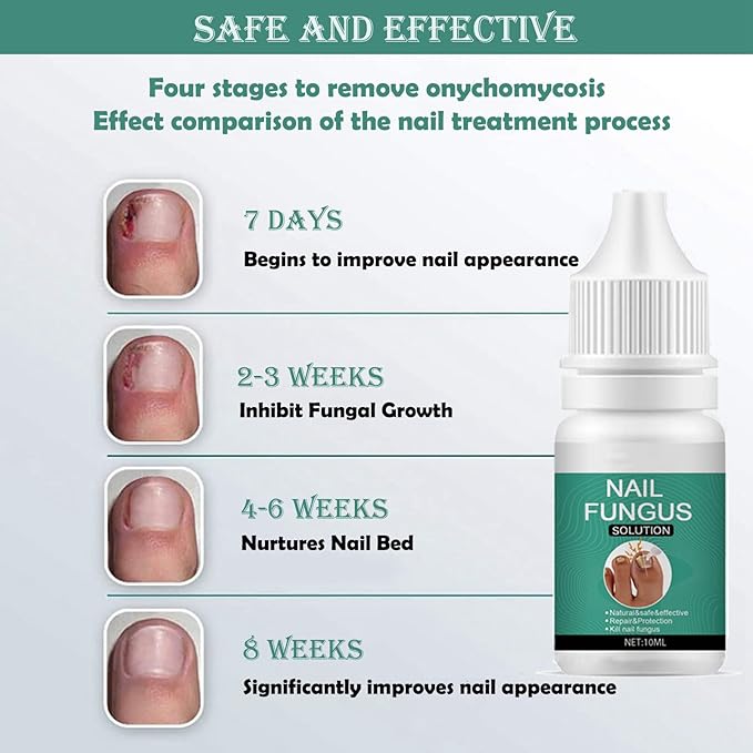 Nexusdrop Nail Fungus Solution - Image 3
