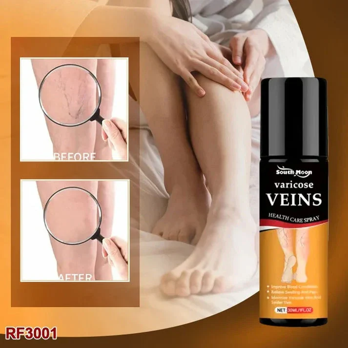 Turmeric Vericose Vein Relief Spray - Image 2