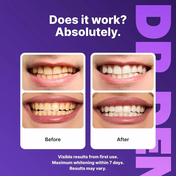 Purple Instant Teeth Whitening Strips 7 Pairs (14 Strips) - Image 5